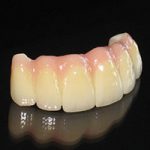 Zirconia01