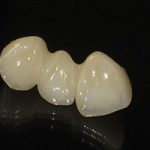 Zirconia02